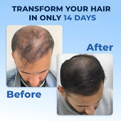 FEG Hair Growth Spray β Fast Hair Regrowth & Strength for Thinning Hair
