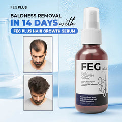 FEG Hair Growth Spray β Fast Hair Regrowth & Strength for Thinning Hair