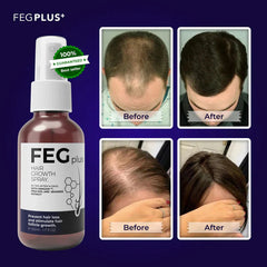 FEG Hair Growth Spray β Fast Hair Regrowth & Strength for Thinning Hair