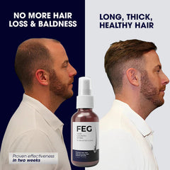 FEG Hair Growth Spray β Fast Hair Regrowth & Strength for Thinning Hair