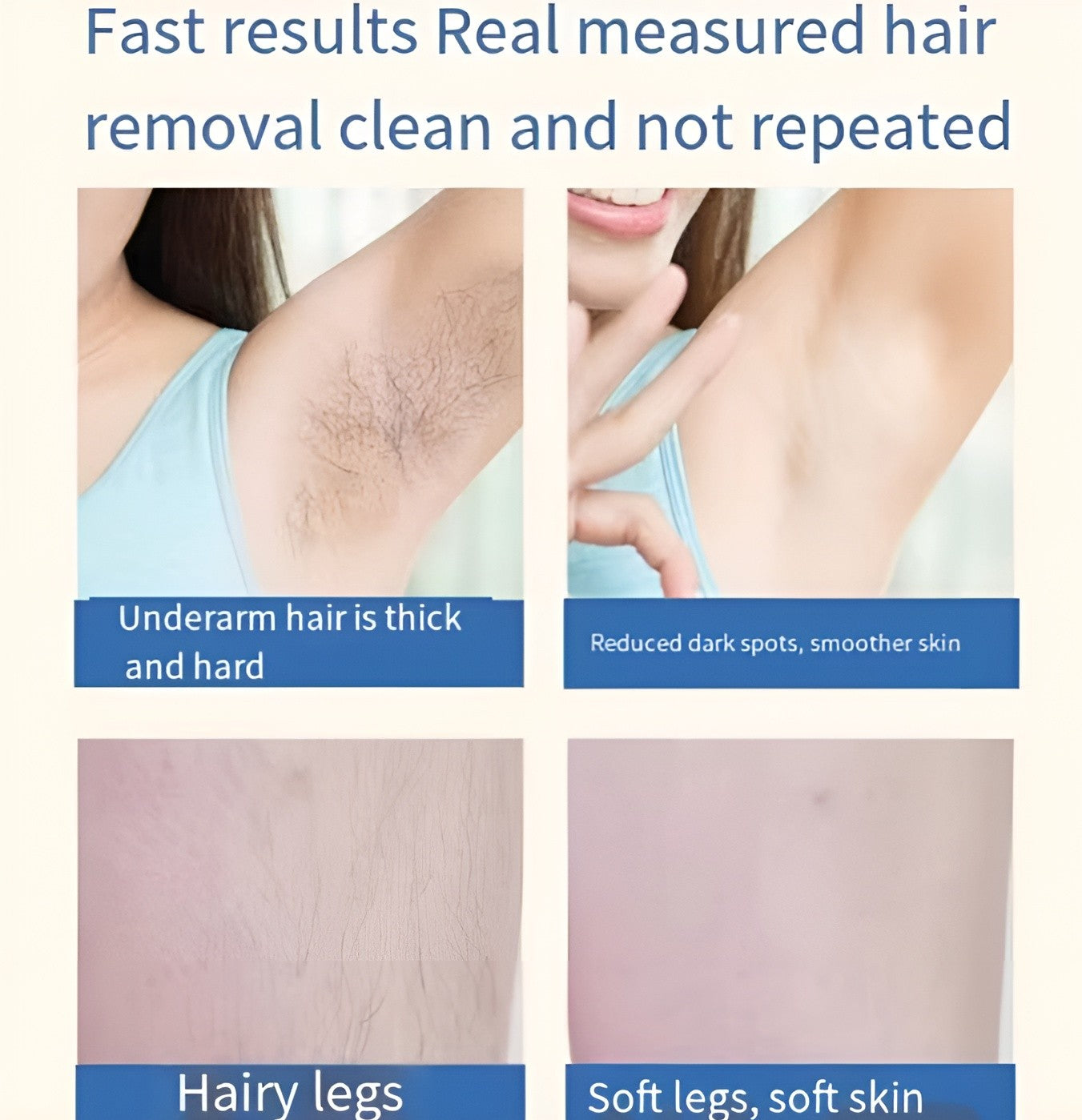 Mini Laser Hair Removal – Smooth Skin, Forever