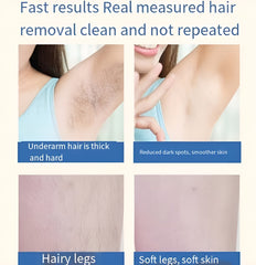 Mini Laser Hair Removal – Smooth Skin, Forever