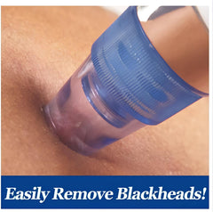 The Beauty Secrets Pore Cleaning Device – Unlock Flawless Skin Instantly!
