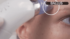 The Beauty Secrets Pore Cleaning Device – Unlock Flawless Skin Instantly!