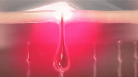 Mini Laser Hair Removal – Smooth Skin, Forever