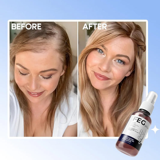 Visible transformation showing thicker, healthier hair after using FEG Plus Hair Growth Spray for a few weeks.