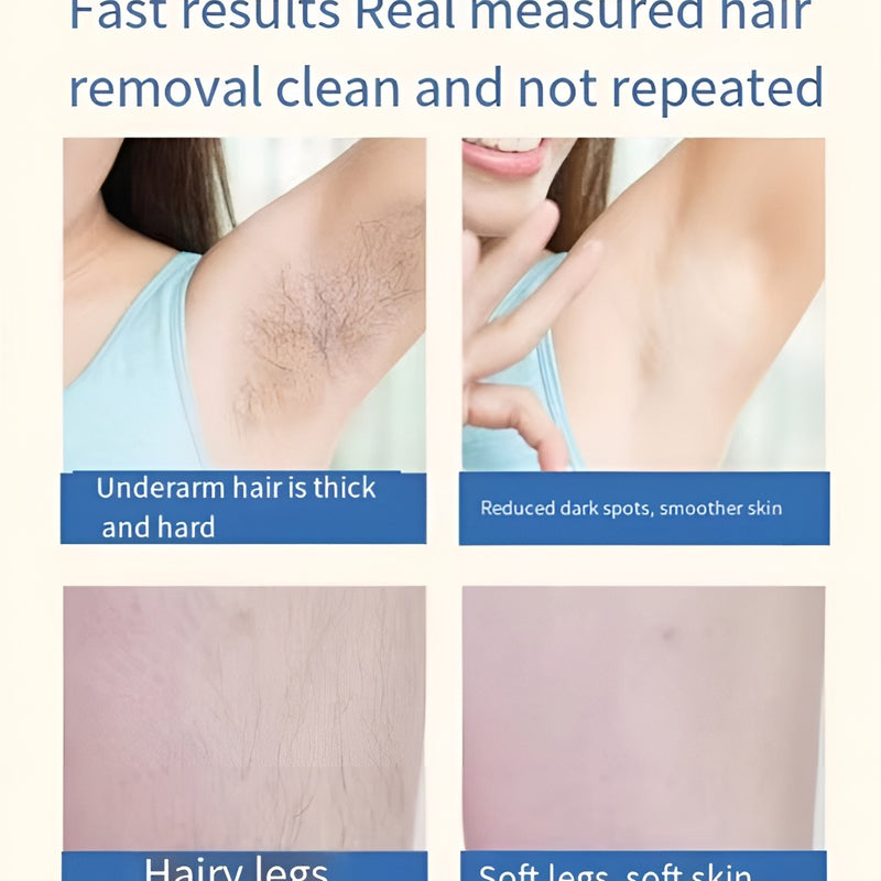 Mini Laser Hair Removal – Smooth Skin, Forever