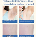 Mini Laser Hair Removal – Smooth Skin, Forever