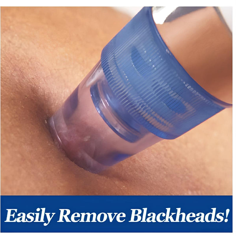 The Beauty Secrets Pore Cleaning Device – Unlock Flawless Skin Instantly!
