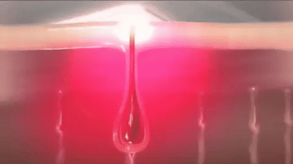 Mini Laser Hair Removal – Smooth Skin, Forever